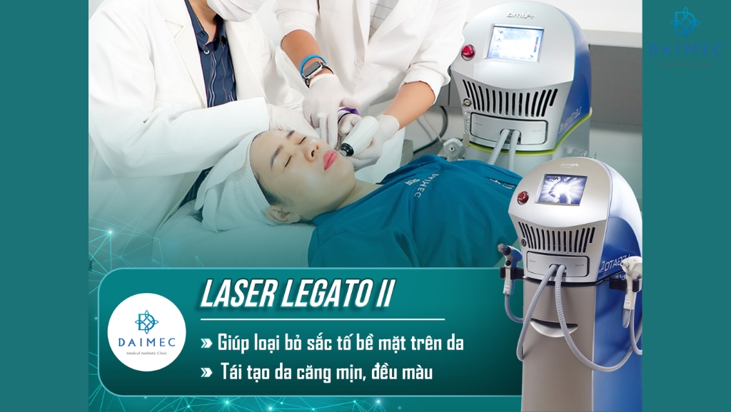 Công nghệ Laser Legato II