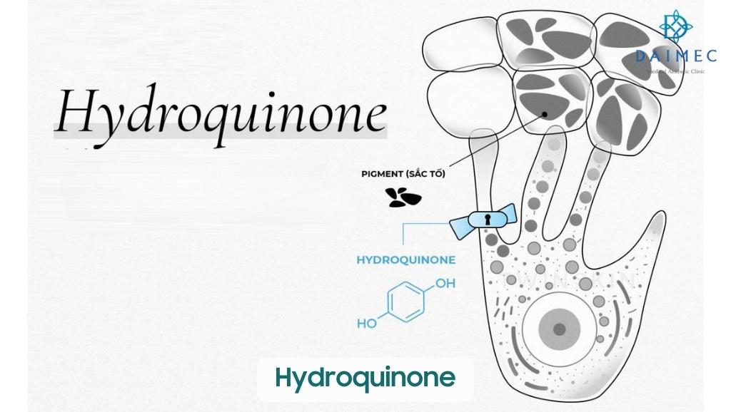 Hydroquinone trị nám