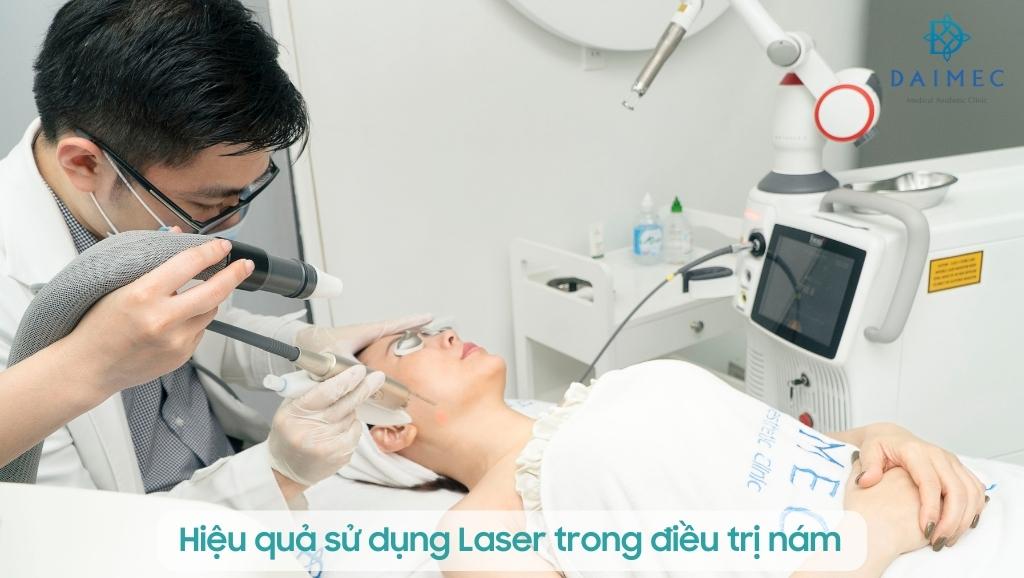 Hiệu quả sử dụng Laser trong điều trị nám