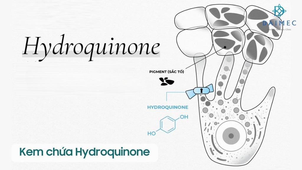 Kem chứa Hydroquinone