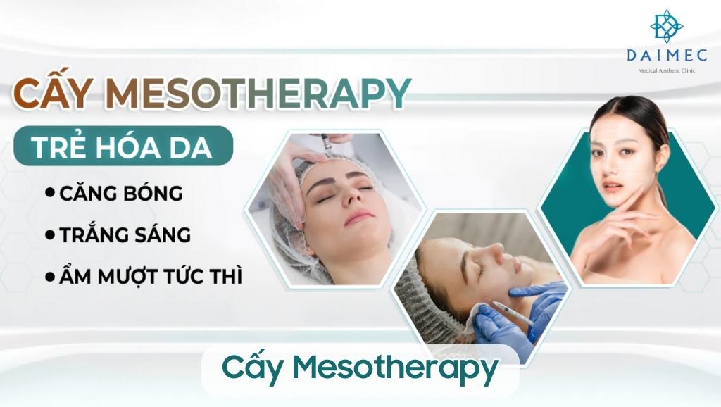 Cấy Mesotherapy