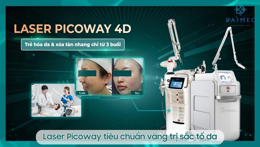 Laser Picoway tiêu chuẩn vàng trị sắc tố da