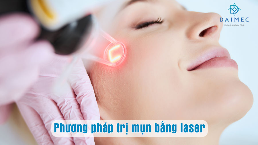 Phương pháp trị mụn bằng laser