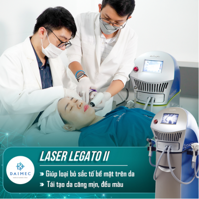 laser legato II